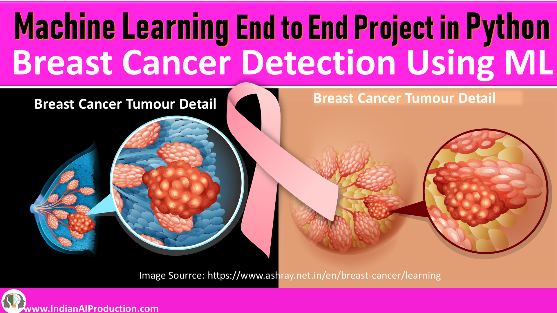 Breast-Cancer-Detection-Machine-Learning-Project
